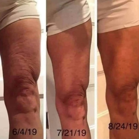 Hibiscus + honey cellulite firming lotion - Picture 2 of 3